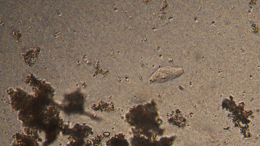 The nematode worm moves in undulating movements. Theme of laboratory ...
