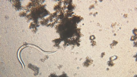 pinworm parazita vagy sem a férgek meghalnak e hőmérsékleten