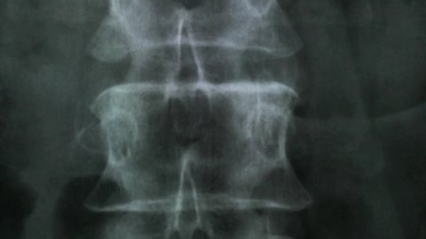 X-ray of the bones of the human vertebral column and pelvis, 4K