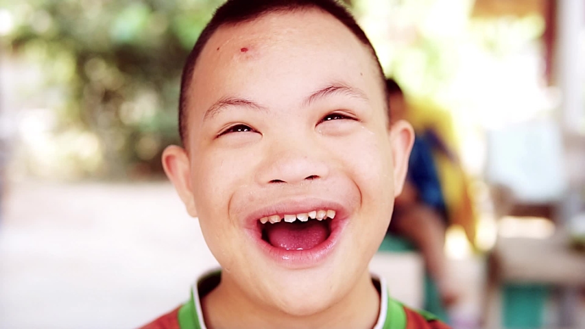 Happiness Down syndrome boy with friendly smile and laughing slow motion. Close up shot selected focus. | Shutterstock HD Video #1045953481