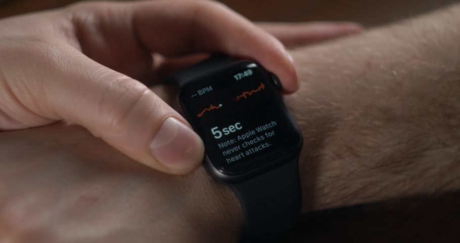 apple watch 4 echocardiogram