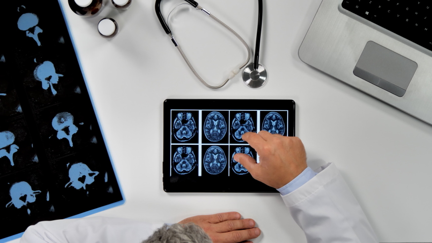 top down view of a doctor checking x-rays at his desk to examine parkinson's disease Royalty-Free Stock Footage #1046497093
