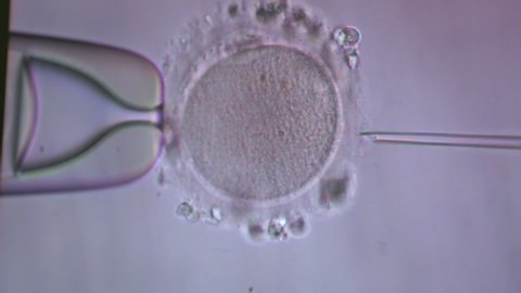 Filming of process of fertilization of female egg, sperm penetrates, genetics, IVF, gynecology, conception of new life, laboratory manipulations, under microscope, precise movement, human population