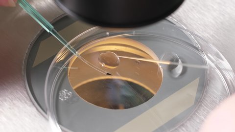 Close-up of filigree laboratory manipulation, moving of embryo from cryoprotectant to special medical tool for subsequent freezing. Specialist using pipette to take embryo and place in liquid nitrogen