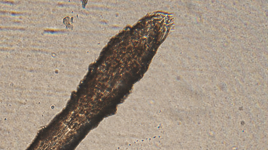 âˆš100ä»¥ä¸Š human hair root under microscope 340699-What does a human hair