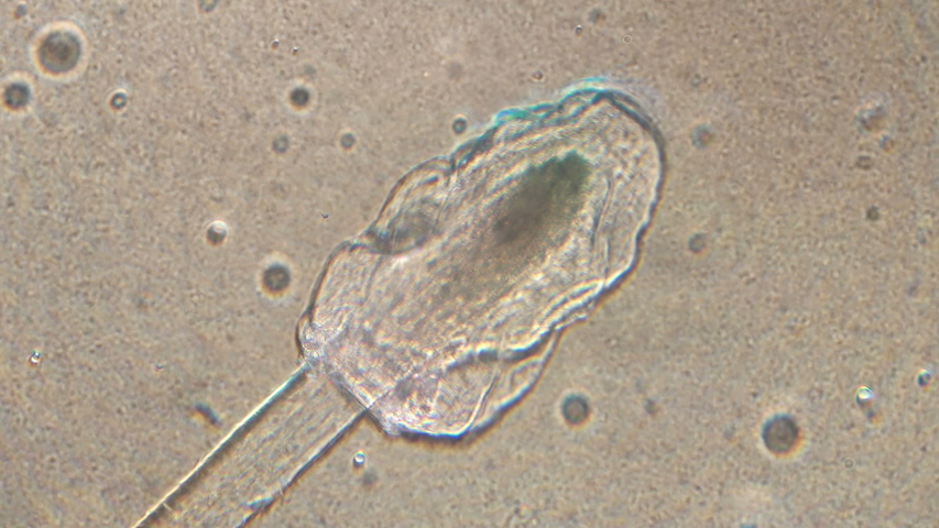 human hair root microscope