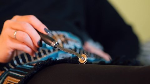 Close-up of a Wartenberg wheel on a patient’s leg with a neurologist. Wheel with needles moves on the connecting rods. The concept of psychological relaxation of a person.