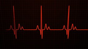 Loopable: Red 3D EKG/ECG cardiogram oscilloscope monitor heartbeat line chart shows 60 BPM heart rate on black background with grid.