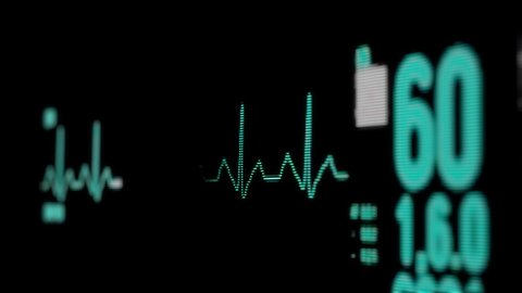 Heart rate monitor in hospital theater. Medical vital signs monitor instrument in a hospital on anesthesia surgery monitor. ECG. Patient heartbeat at the screen