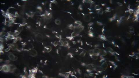 The study of chicken sperm under the microscope view in laboratory.
