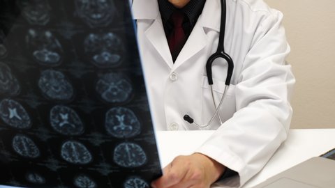 A male dortor or neurologist stydying a MRI scan film.