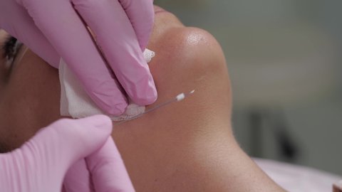 The procedure of lifting the face using special threads. Doctor beautician inserts a needle into the skin of the client.