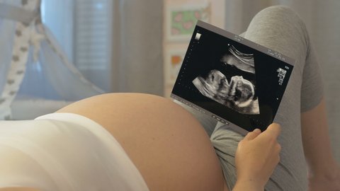 Expectant mother looks at a picture of her unborn child. Utrasound examination of the fetus in hands of a pregnant woman. The nine months of pregnancy, conceptual footage