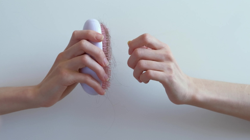 Many hair fall after combing in hairbrush on white background in woman hands. Hair loss problem, postpartum period, menstrual or endocrine disorder, hormonal disbalance, stress concept. Copy space. Royalty-Free Stock Footage #1048126846
