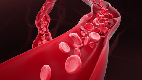 Blood Clot Forming inside a Vein. Red Blood Cells Blocked Inside Artery are Pushed by High Pressure Fixing the Clot and Healing Veins.