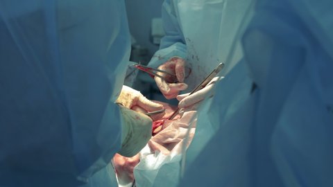 Surgical procedure with stitching performed by the doctors