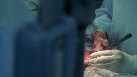 Patient's wound is being stitched during surgery