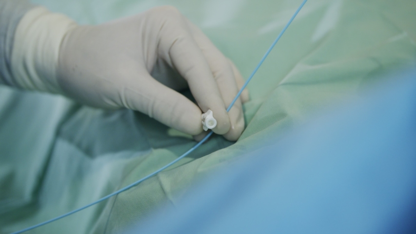 Close up on Surgeon hand during a heart catheterization Royalty-Free Stock Footage #1048899289