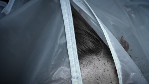 4k Dead Human Body Cadaver Laying Stock Footage Video (100% Royalty