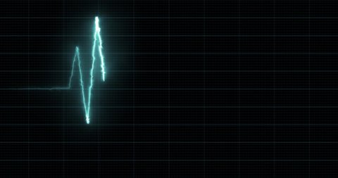 EKG - Heartbeat Display Monitor - Motion Graphics, HUD Element