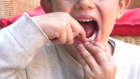 
5 year old male child caucasian boy  with baby teeth is about to lose the first teetering tooth