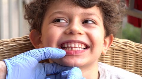 5 year old male child caucasian boy  with baby teeth is about to lose the first teetering tooth , relates to the father dentist who, with the dental floss, removes the milk tooth