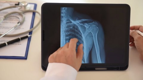 doctor looking at x-ray image of shoulder joint in digital tablet screen  for to see injuries of tendons and bones.