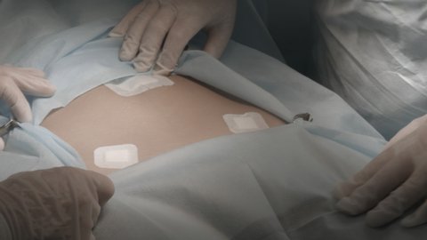 Operation Process Operating Room Stock Footage Video (100% Royalty-free ...