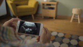 Pregnant Woman Looking at Ultrasound Scan on Smartphone Sitting on Sofa at Home. Third trimester pregnancy. Pregnant Woman Looking Ultrasound Video Her Baby on Mobile Phone. Gynecology Birth Childbirt