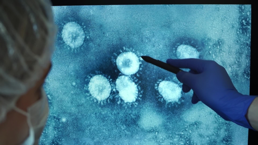 Close up of photo of virus under microscope on computer monitor screen on background of team of doctors. Scientists in laboratory discuss Coronavirus