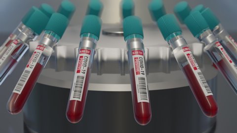 Coronavirus blood test positive Analyzing blood sample in test tubes for coronavirus test. Tubes with blood for 2019-nCoV or COVID-19 test. 3D rendering 4K