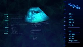 Ultrasound ,Sonogram Procedure to baby or fetus development and pregnancy. Futuristic Baby Ultrasound with blue tone Analyze HUD screen. - Powered by Shutterstock - Get 15% off with code: PIKWIZARD15