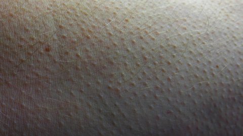 Goosebumps Appearing on Male Forearm Skin Fast Motion Close Up