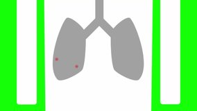 Animated illustration of virus infection like coronavirus (COVID19) of respiratory tract and lungs using red particles. The particles change to blue, yellow & disappear to visualize immune response - Powered by Shutterstock - Get 15% off with code: PIKWIZARD15