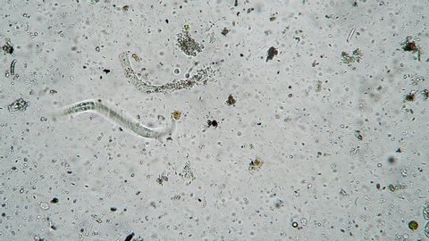 The nematode worm moves among numerous clusters of bacteria and microorganisms. Theme of laboratory biological research under microscope. Microscopic protozoa in a drop of water magnification.