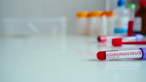 sliding shot Test tube with blood sample for COVID-19 and rapid test for diagnosis Coronavirus infection. Diagnoing, researching testing result, Inhibition of disease outbreaks