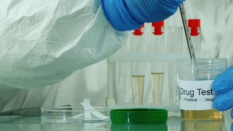 The laboratory technician conducts urine tests for drug and doping. Sports medicine