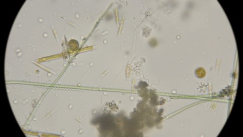 A variety of microorganisms in one drop of water under a microscope, algae, bacteria, microorganisms ...