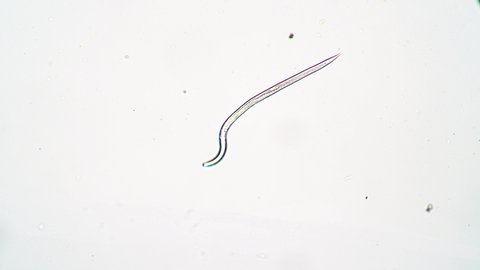 pinworm parazita vagy sem