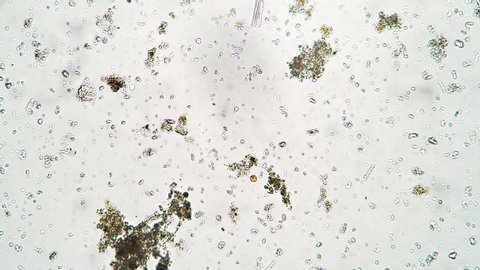 Bacteria and ciliates Colpoda is making it's way in water from Thailand swamp under microscope. The protozoa is floating in it's life environment. Theme of the small creatures living in microcosmos.