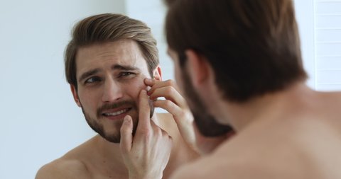 Unhappy young handsome man looking in bathroom mirror feeling worried about facial skin problem. Anxious millennial guy touching face frustrated by blackheads, acne. Men skincare treatment concept.