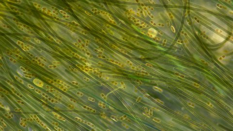 Green algae of the cyanobacteria Oscillatoria under the microscope, the family Oscillatoriaceae, the threads in the colonies can slide and move to the light source for photosynthesis. It is believed