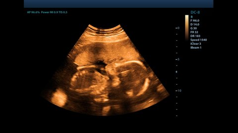 Child Stomach Anatomy Stock Video Footage 4k And Hd Video Clips Shutterstock