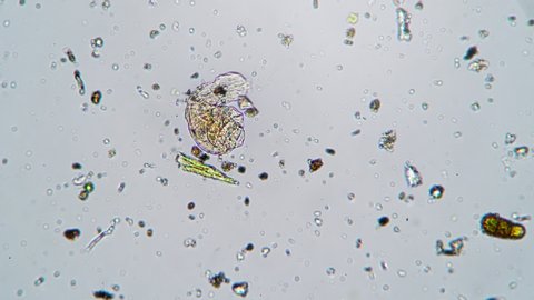 The small rotifier is moving over the field with other animals under the microscope. Tiny protostome is crawling over the area of life. Theme of the small animals and creatures in microcosmos.