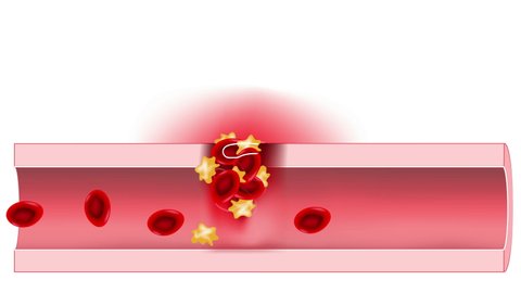 Hemostasis. Red blood cells and platelets in the blood vessel. Basic steps of wound healing process. animation.