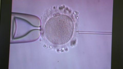 Filming of process of fertilization of female egg, sperm penetrates, genetics, IVF, gynecology, conception of new life, laboratory manipulations, under microscope, precise movement, human population