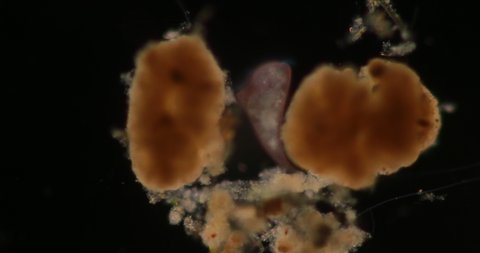 Stentor, sometimes called trumpet animalcules, are a genus of filter-feeding, heterotrophic ciliates, representative of the heterotrichs in waste water under the microscope.
