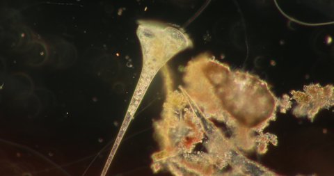Stentor, sometimes called trumpet animalcules, are a genus of filter-feeding, heterotrophic ciliates, representative of the heterotrichs in waste water under the microscope.
