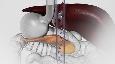 The functioning of the glucose balancing pancreas