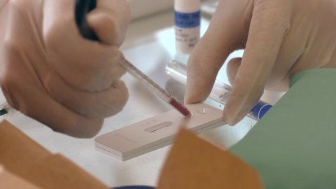 Medical laboratory technician placing blood sample specimen on quick rapid diagnostic test using pipette,Coronavirus infected patient antibodies diagnosis,  NHS SARS-CoV-2 point of care fast testing